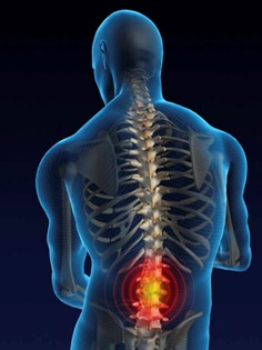 Lower Back Pain Causes Risk Factors And Solutions Fittgram